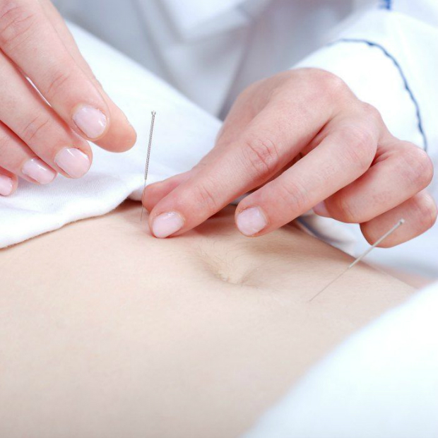 Get To Know The Importance Of Acupuncture For A Smooth Fertility